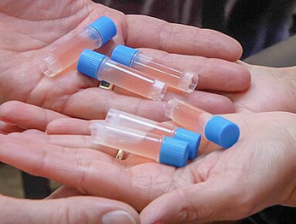 Stem cell vials in hands ama regenerative medicine
