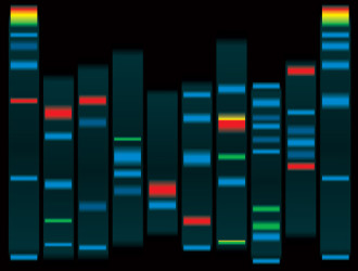 Misc 19 DNAProtein Gel