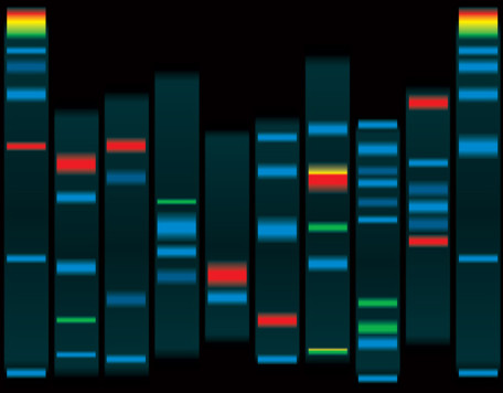 Misc 19 DNAProtein Gel